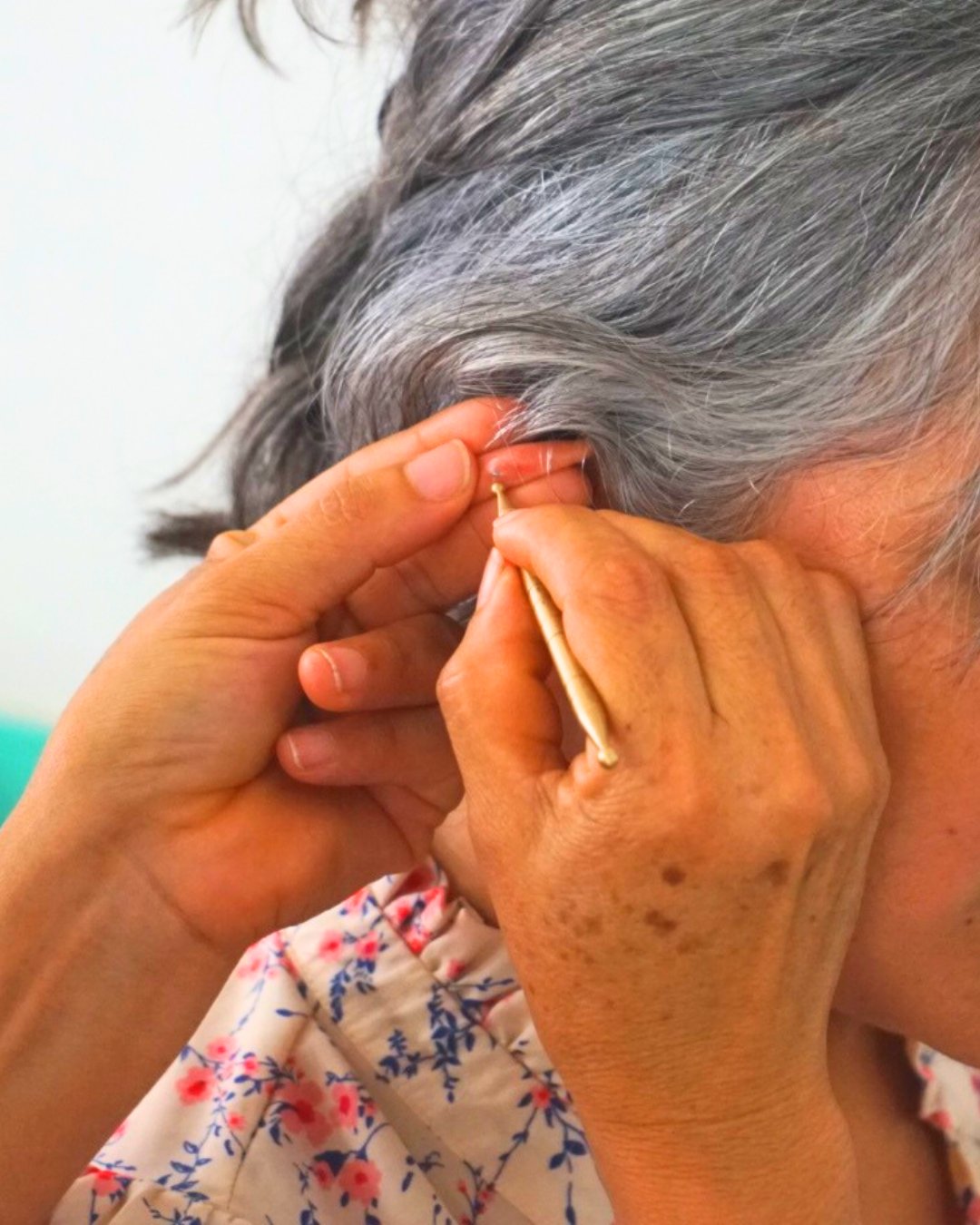 Auriculoterapia